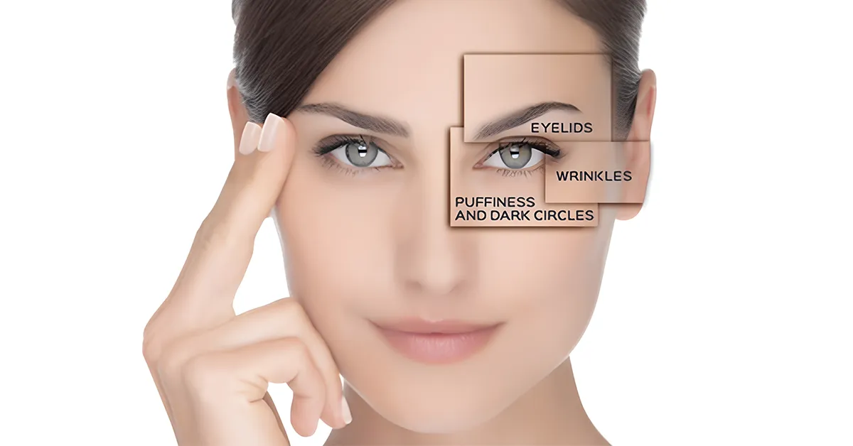 Eye Wrinkle Treatment Kirkcaldy